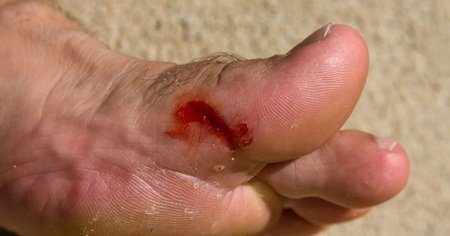 Left or right t tano